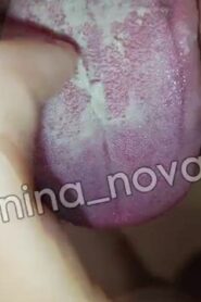 Watch – White dirty tongue scraping