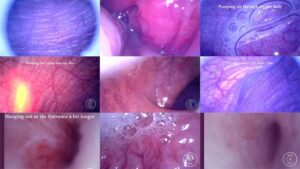 Watch – COMPILATION: Endoscope in my Dick, Ass and Bladder